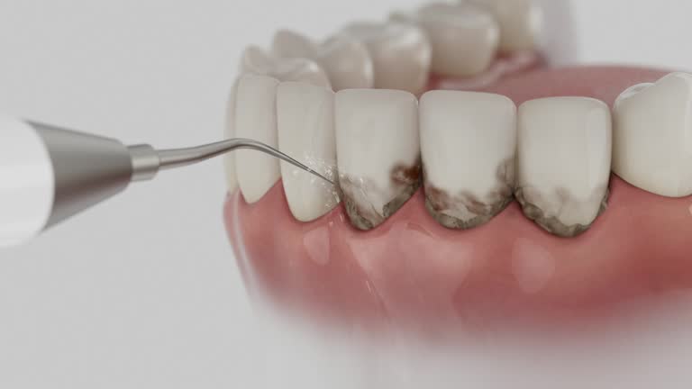 Reliable Emergency Dentist contractor in Canton, MS by Smile Center Dentistry